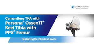 Cementless TKA with Persona® OsseoTi® Keel Tibia with PPS® Femur featuring Dr. Charles Lawrie